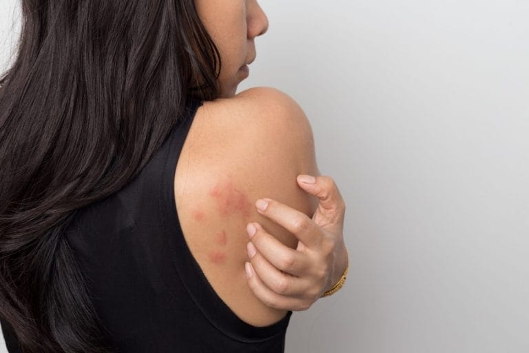 Cancerul de piele: semne timpurii și prevenție eficientă Cancerul de piele
