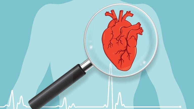 Ghid complet pentru un stil de viață cardio protector