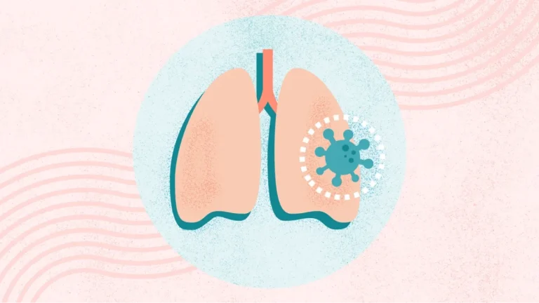 Pneumonia